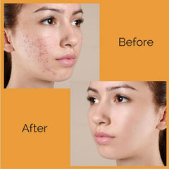 Brightening Cream - The Skin Story